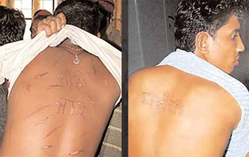 Victime de la torture Victime de la torture