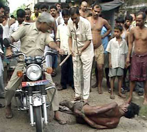 Victime de la torture Victime de la torture