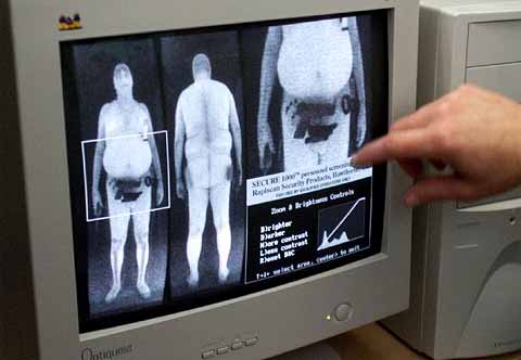 Image d'un scanner corporel