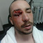 violence policière au Canada