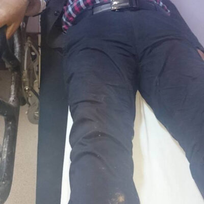 L'un des 4 Kurdes blessé par les militaires turques.