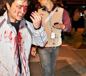 Lin Ming-hui, fraichement matraqué lors de l'occupation du parlement taïwanais.