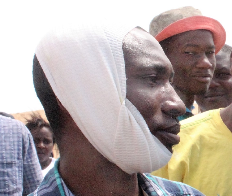 Un des manifestants touché par une balle de caoutchouc