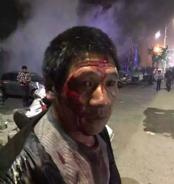 Un manifestant matraqué