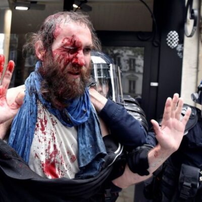 Manifestant blessé cet après-midi à Paris