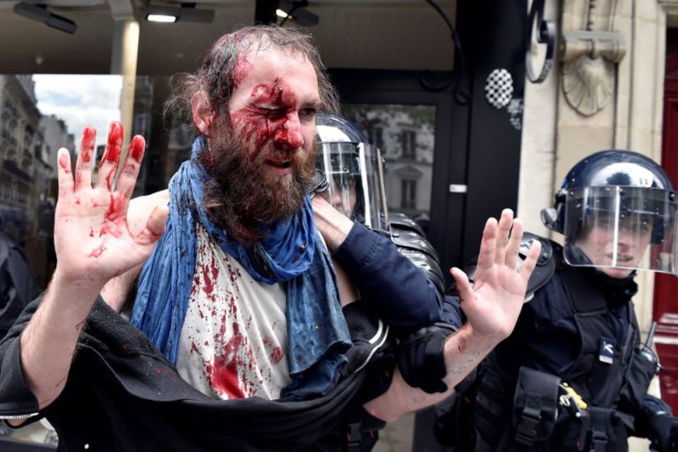 Manifestant blessé cet après-midi à Paris