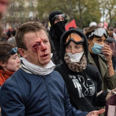 Le syndicaliste éborgné par la police