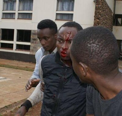 Un étudiant blessé à Nairobi