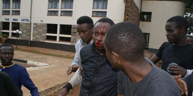 Un étudiant blessé à Nairobi