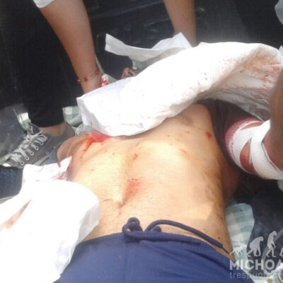 Un manifestant a été touché au cou par une balle de la police