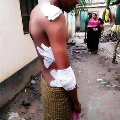 Travailleur blessé lors de l'attaque de la manifestation