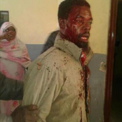 Une victime de la répression de mardi