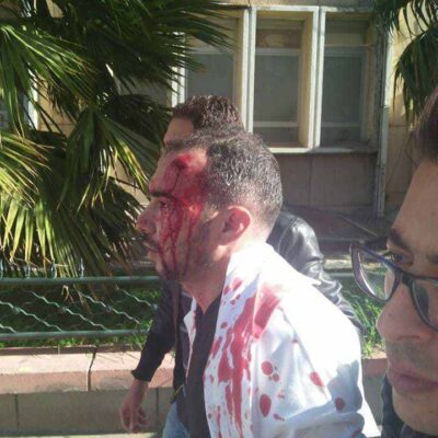 Un des médecins matraqués par les forces anti-émeutes