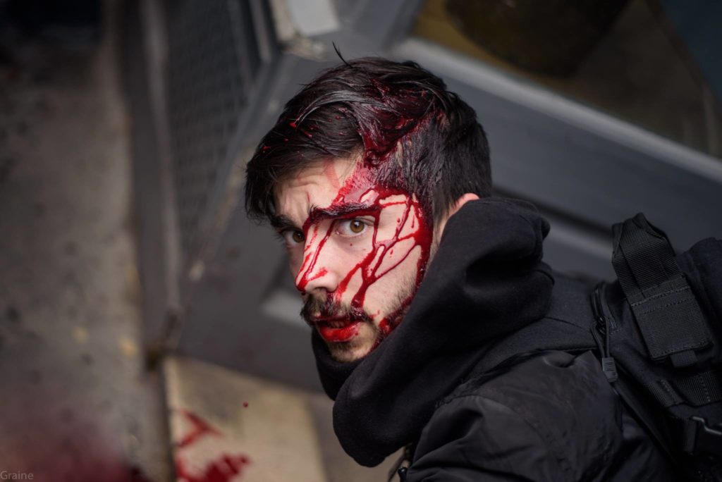 Photographe blessé par la police.