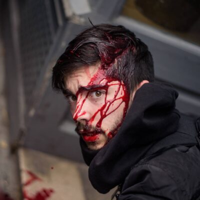 Photographe blessé par la police.