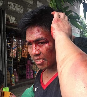 Gréviste de NutriAsia blessé par la police 