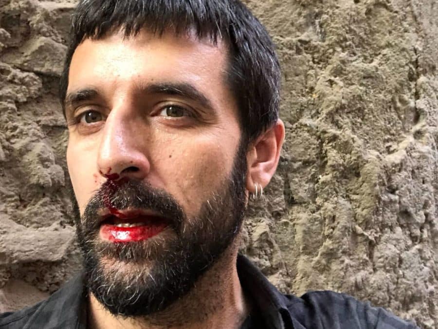 Le journaliste Jordi Borràs après avoir été agressé
