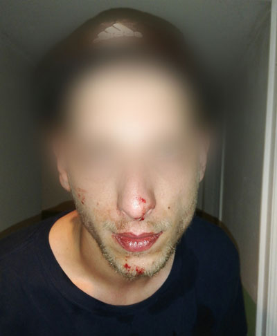 Notre camarade, une demi-heure après l'agression. Notre camarade, une demi-heure après l'agression.