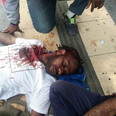 Manifestant blessé lors des marches commémorant l'accord de New-York de 1962