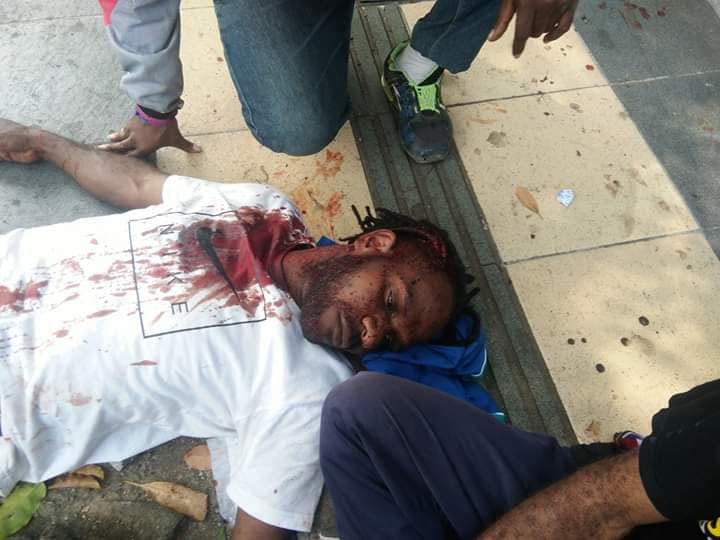 Manifestant blessé lors des marches commémorant l'accord de New-York de 1962