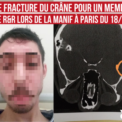 Fracture du crâne pour un militant de R&R lors de l'acte 62 des Gilets Jaunes