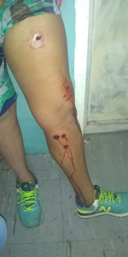 Une prisonnière de la prison d'El Borbollón