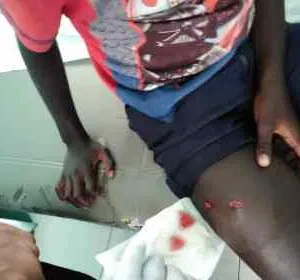 Manifestant blessé à Haïti