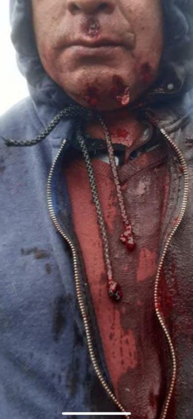 Les forces spéciales des Carabineros ont tiré sur les manifestant·es avec du plombs