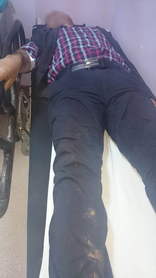L'un des 4 Kurdes blessé par les militaires turques.