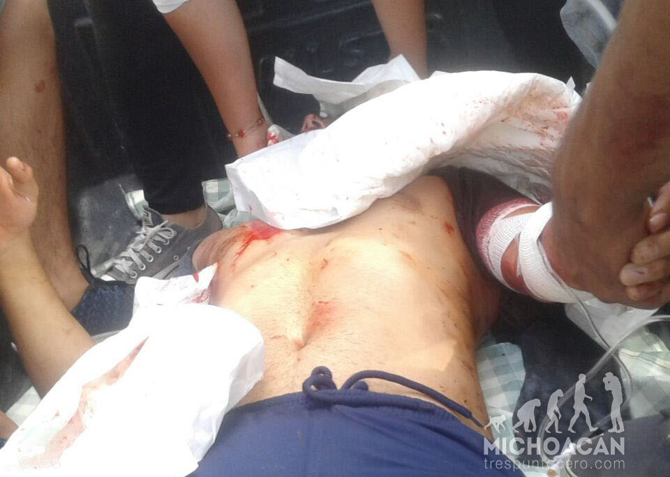 Un manifestant a été touché au cou par une balle de la police