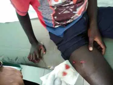 Manifestant blessé à Haïti